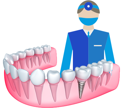 Cirugía Implantes dentales